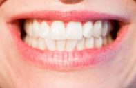 piękny uśmiech - implanty zębowe